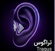 تراگوس